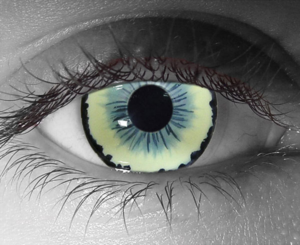  contact lenses