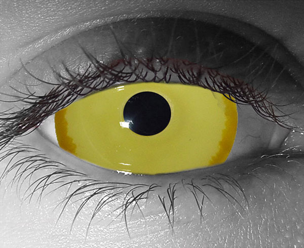  contact lenses