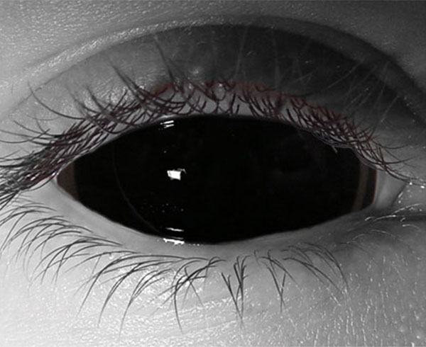  contact lenses