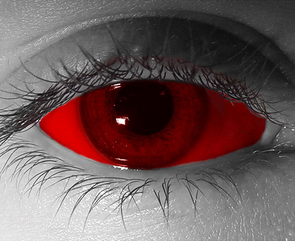  contact lenses