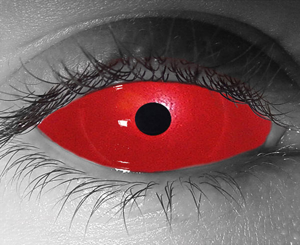  contact lenses