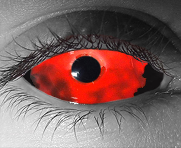  contact lenses