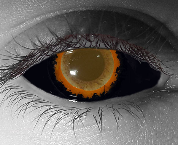  contact lenses