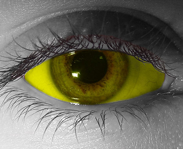  contact lenses
