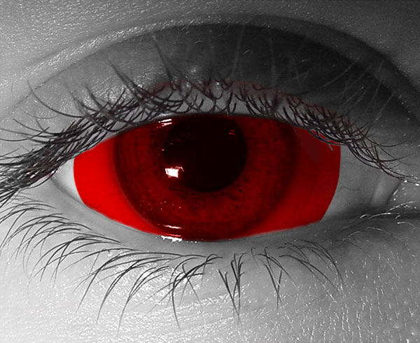  contact lenses